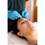 clinica especialista em acupuntura para hérnia de disco Recanto das Emas (Recanto das Emas)